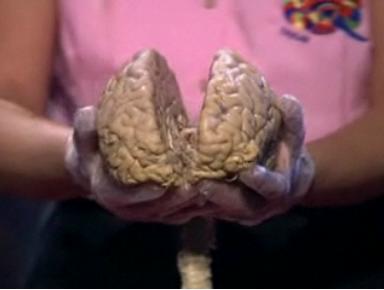Human Brain showing 2 halves