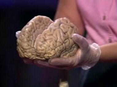 Human Brain showing 2 halves